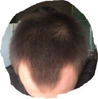 1000x1010