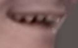 399x249