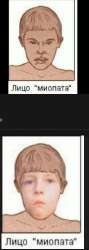 236x659