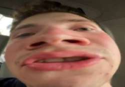 545x379