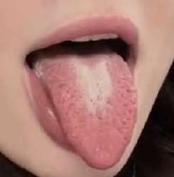 295x300