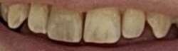 810x235