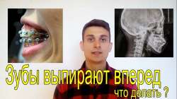 1280x720