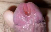 61