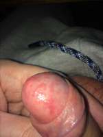 88