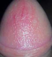 163