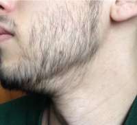 80