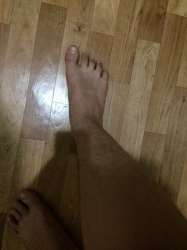 148