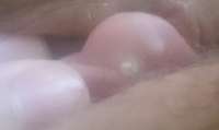 107