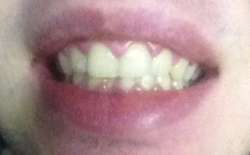 94