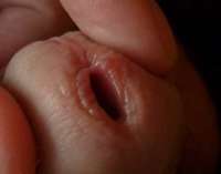 500x393