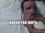 67