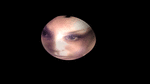 135