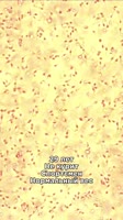 576x1024