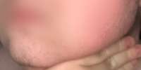 715x361