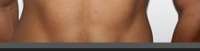 281x72