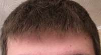 720x398