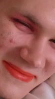 720x1280