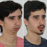 1080x1080