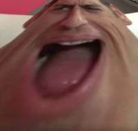 400x381