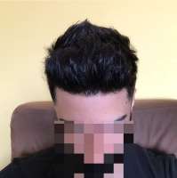 794x797