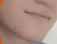 395x305