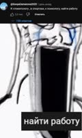 650x1080