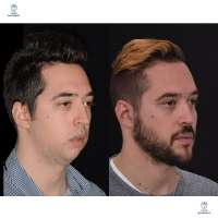1080x1080