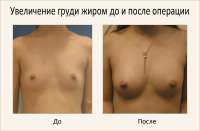400x262