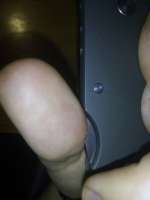 62