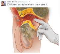 192